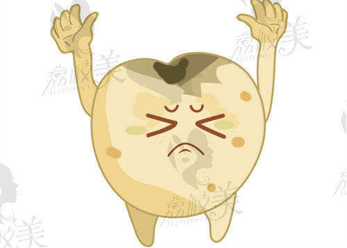 嵊州杭成口腔补牙
