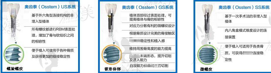 全口即刻种植比常规贵多少钱