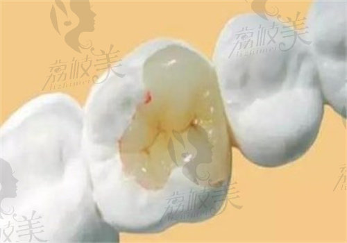临海爱齿口腔医院补牙怎么样
