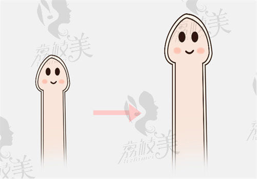 男性埋线降敏手术价格表