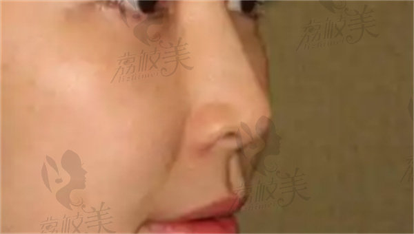 赤峰红山伊莲美人医疗美容诊所