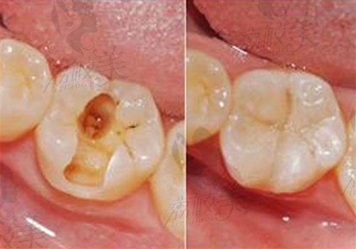 如皋固德口腔医院补牙怎么样