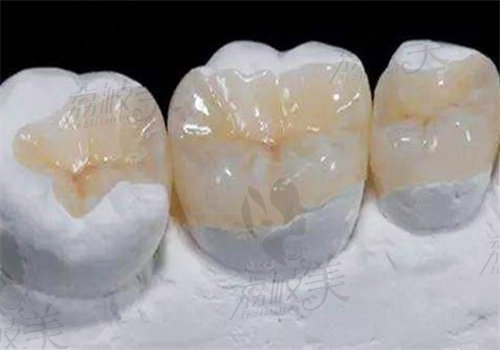 如皋固德口腔医院补牙怎么样