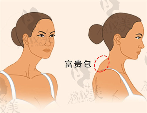 广州李方伟他的技术怎么样