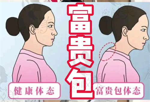 李方伟富贵包治疗