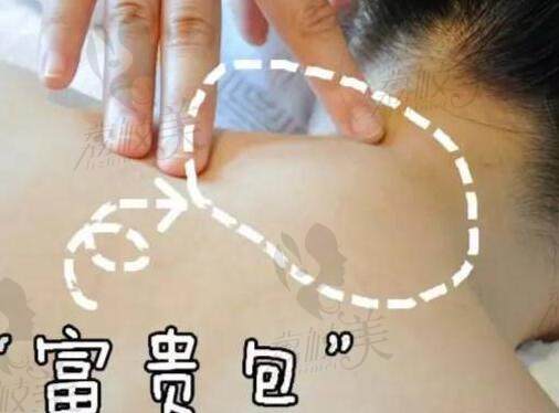 國內(nèi)哪家醫(yī)院富貴包做的好