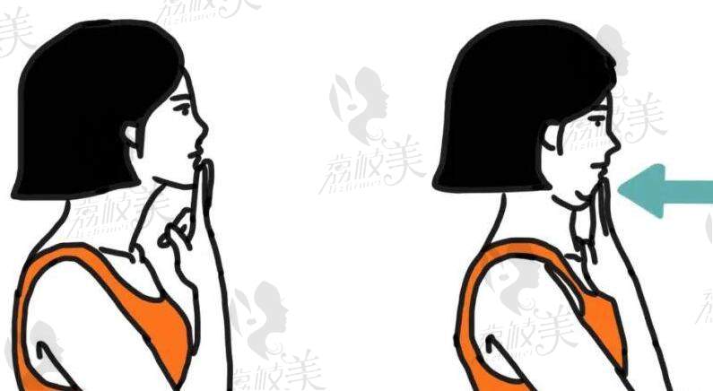 國內(nèi)哪家醫(yī)院富貴包做的好