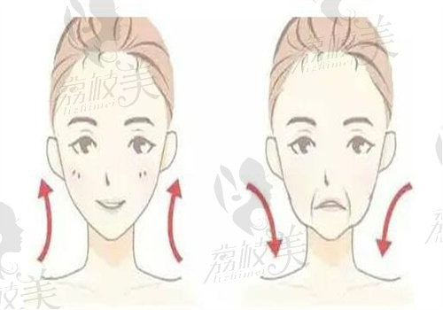 北京四季青橙楊俊做中下部面部提升多少錢