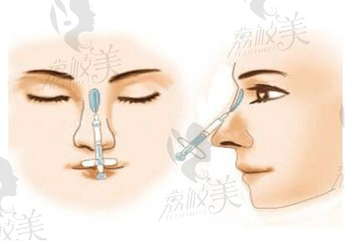 师俊莉擅长项目手术实例合集