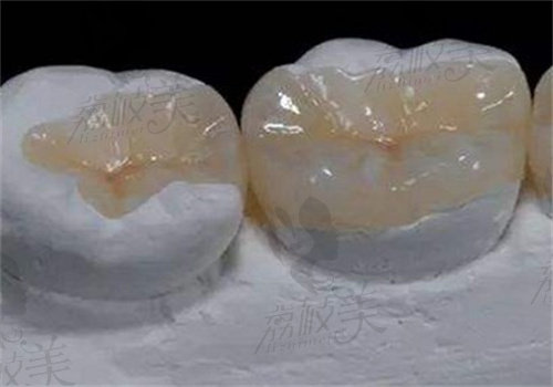 杭州薇琳口腔医院口碑怎么样