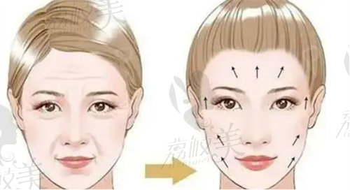 筋膜懸吊怎么感覺臉變大變寬了