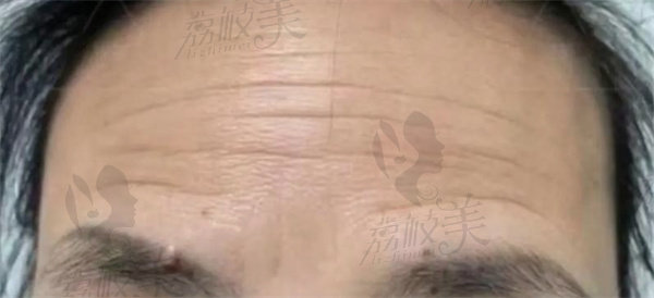 海南华大医疗美容门诊部阴明星