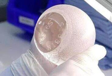 曾昂医生2025年手术价格