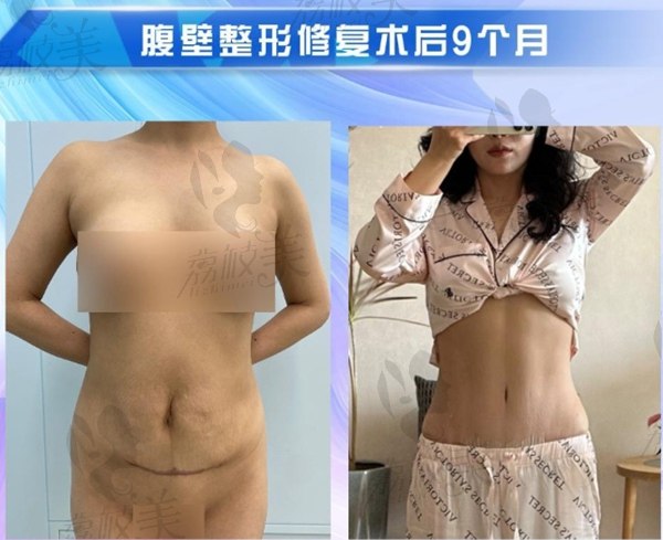 崔鑫醫(yī)生