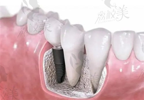 日照瑞美口腔口碑怎么样