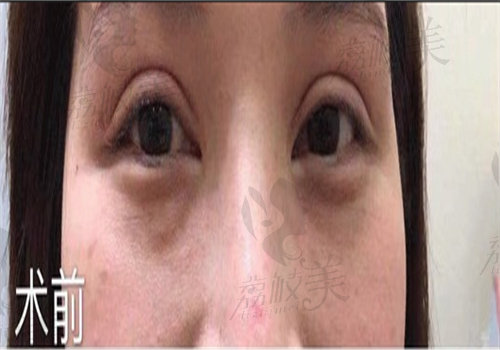 吕方中医生面诊流程