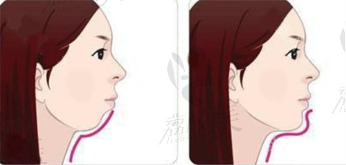 李继华医生的评价和口碑
