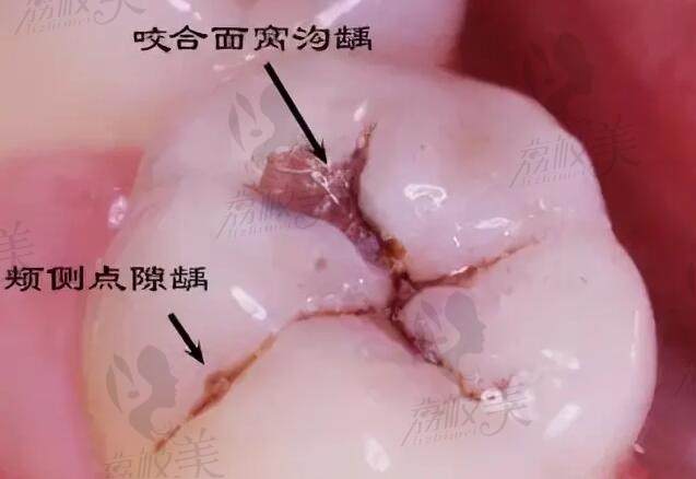 山东省口腔医院价目表
