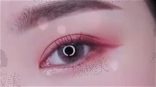 张冰洁卧蚕再造到底好吗