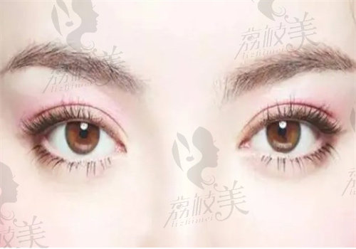 为什么选择周瑜医生修复双眼皮