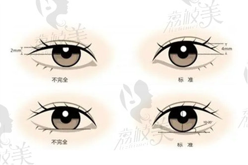 成都林靖修复眼睛技术怎么样