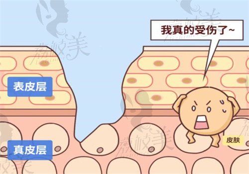 武晓莉近期疤痕修复实例