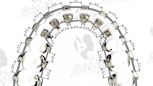 正畸徐宝华和张栋梁谁好