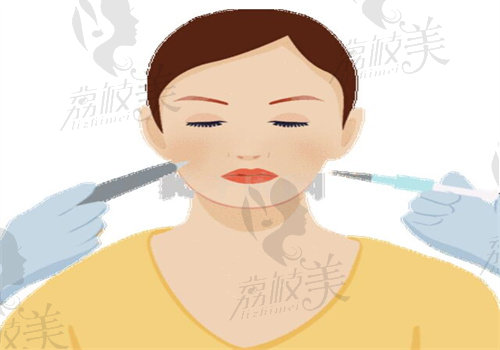 遼寧曙光劉春曉做內(nèi)外輪廓固定技術(shù)特點(diǎn)