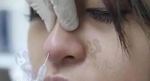 洛阳哪个医院打玻尿酸好