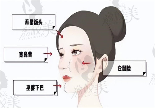 上海王洪医生面部馒化修复美学理念好