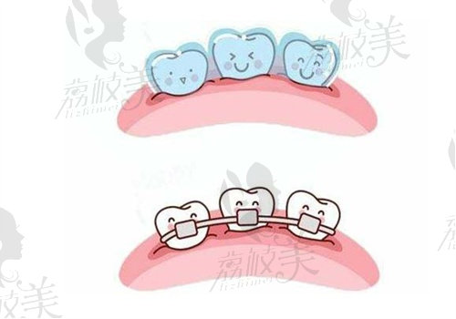 湖州英博口腔醫(yī)院做牙齒矯正怎么樣