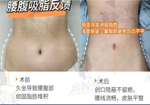 吕光全医生相关实例
