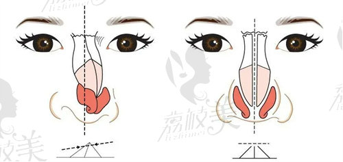 北京安陽(yáng)醫(yī)生口碑怎樣