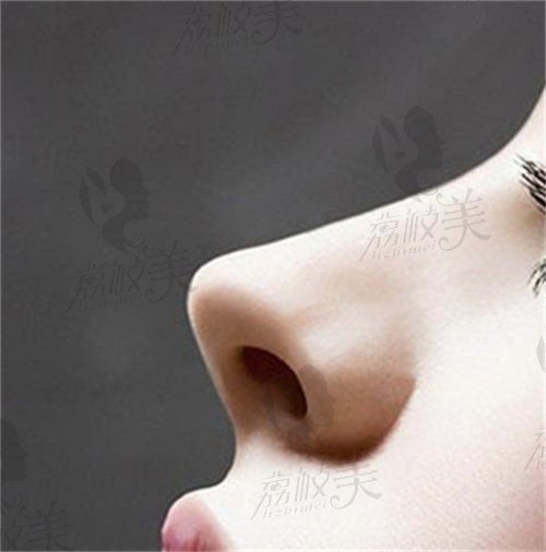 北京安陽(yáng)醫(yī)生鼻綜合價(jià)格