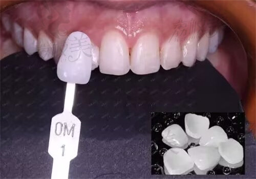 洛阳维乐口腔医院有几家分院