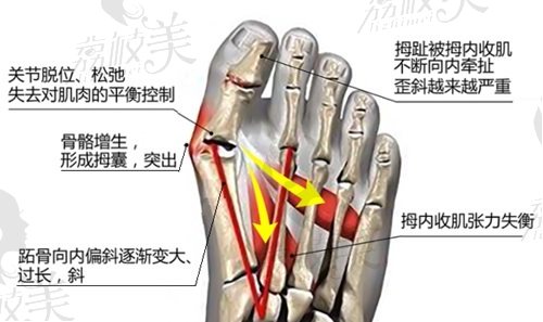 蘇敬達(dá)做大腳骨手術(shù)技術(shù)水平怎么樣？