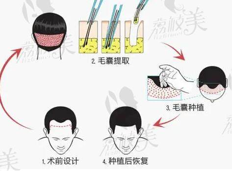 合肥青穗植发医院联系电话