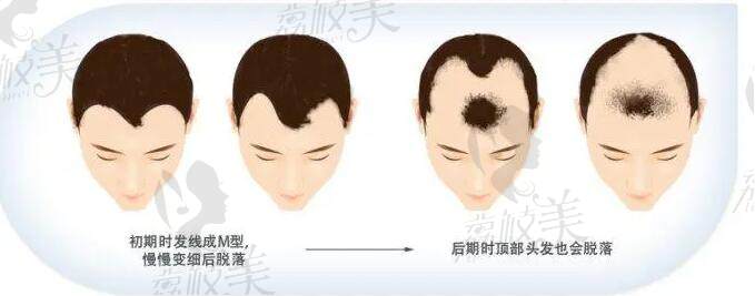 合肥青穗植发预约挂号