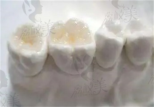 昆明尔迦口腔医院补牙怎么样
