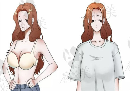 為什么決定做縮胸