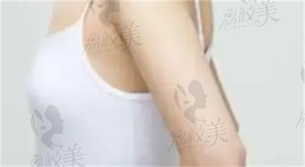 哈尔滨韩美黄庆祝医生脂肪丰胸
