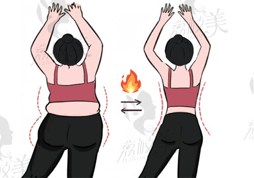 王明利醫(yī)生10例吸脂手術(shù)實例