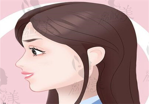 瞿健醫(yī)生做鼻子多少錢