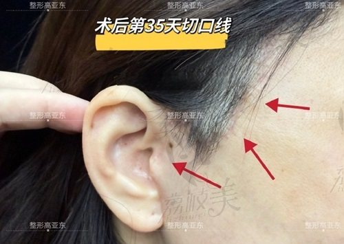 高亞東醫(yī)生在哪里做手術(shù)？