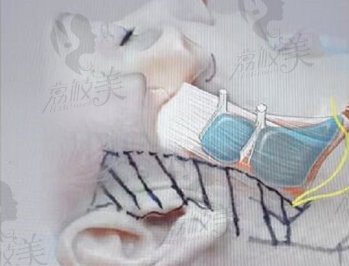 高亞東醫(yī)生在哪里做手術(shù)？