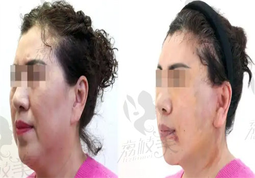 王乙立医美口碑与评价