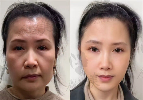 王乙立医生可信吗