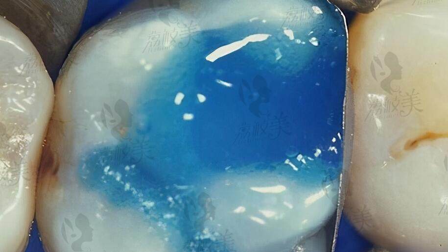 重庆南桥寺附近牙科诊所哪家好