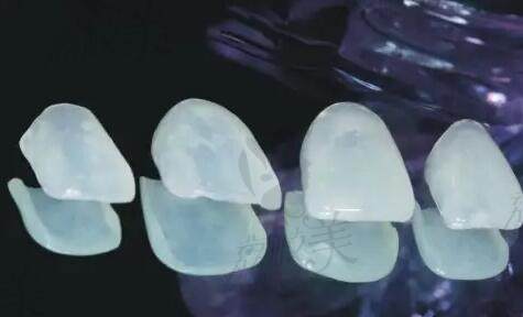 長沙優(yōu)仕口腔牙齒美白價(jià)格