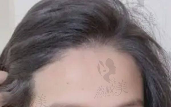 宁波亚植植发优质的服务体验